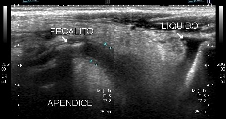 CURSO DE AVALIAÇÃO ULTRASSONOGRÁFICA DO TRATO GASTROINTESTINAL