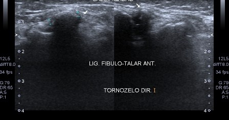 10ª Jornada brasileira de ultrassonografia musculoesquelética
